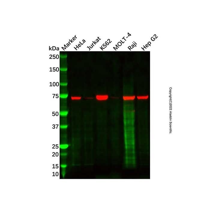 Recombinant IRAK2 Antibody -    by Aladdin Scientific