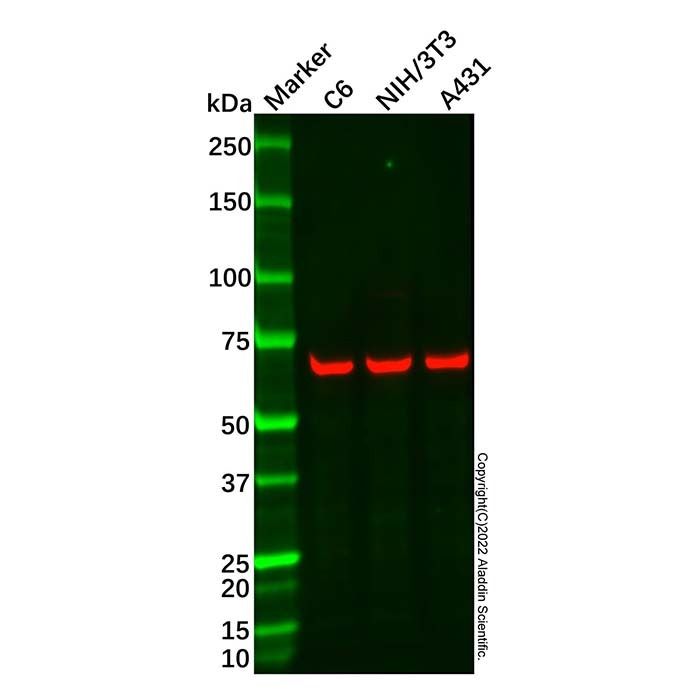 Recombinant IRAKM Antibody -    by Aladdin Scientific