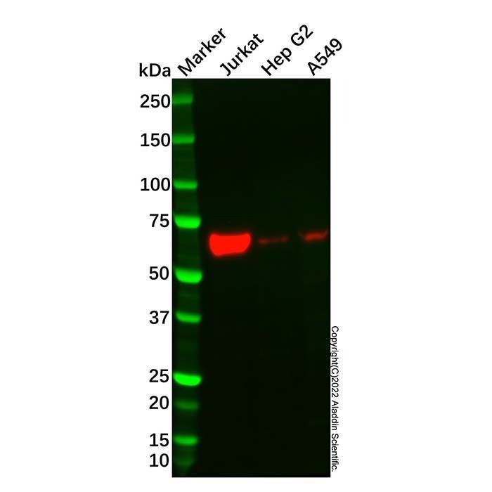 Recombinant IRF6 Antibody -    by Aladdin Scientific