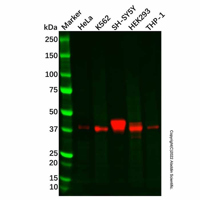 Recombinant Islet 1 Antibody -    by Aladdin Scientific