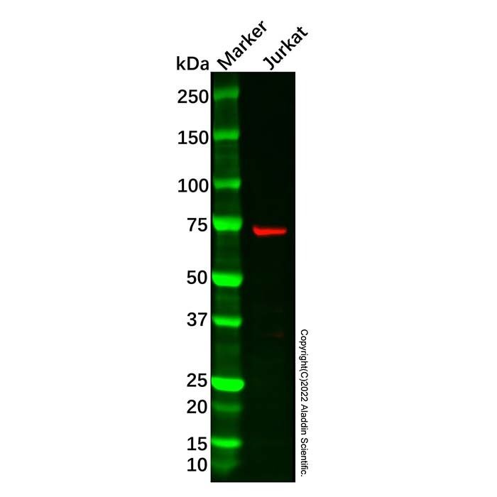 Recombinant ITK/EMT Antibody -    by Aladdin Scientific
