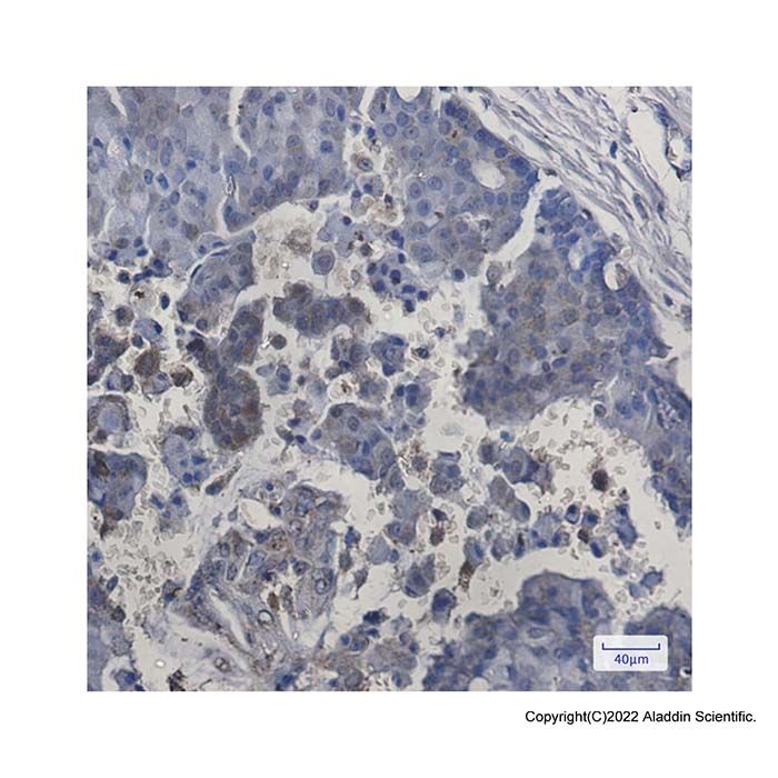 Recombinant ITPA Antibody -    by Aladdin Scientific