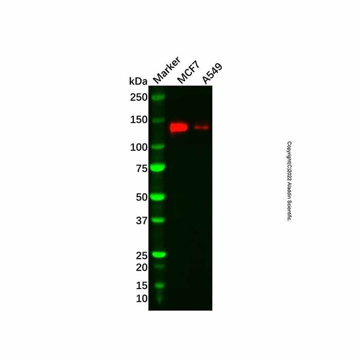 Recombinant JAK1 Antibody -    by Aladdin Scientific