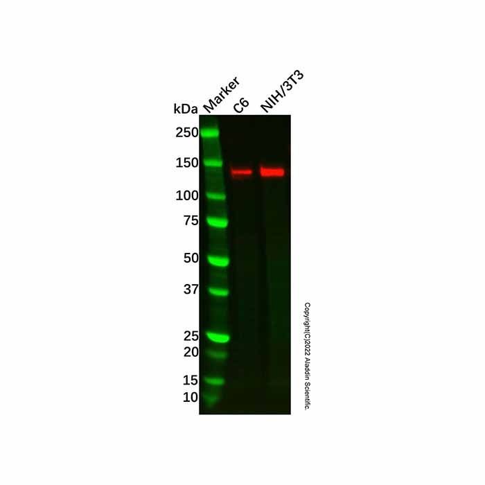 Recombinant Jarid2 Antibody -    by Aladdin Scientific
