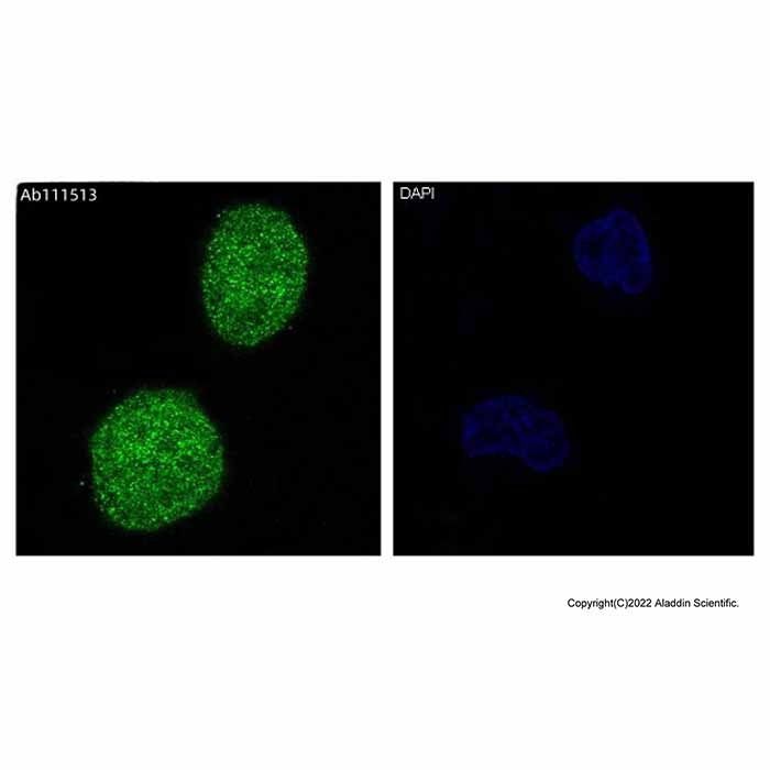 Recombinant JNK1/JNK2/JNK3 Antibody -    by Aladdin Scientific