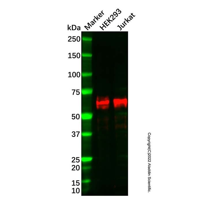 Recombinant KAT7/Hbo1/MYST2 Antibody -    by Aladdin Scientific