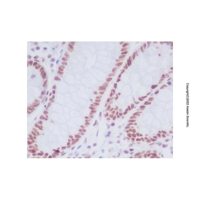 Recombinant KDM1/LSD1 Antibody -    by Aladdin Scientific