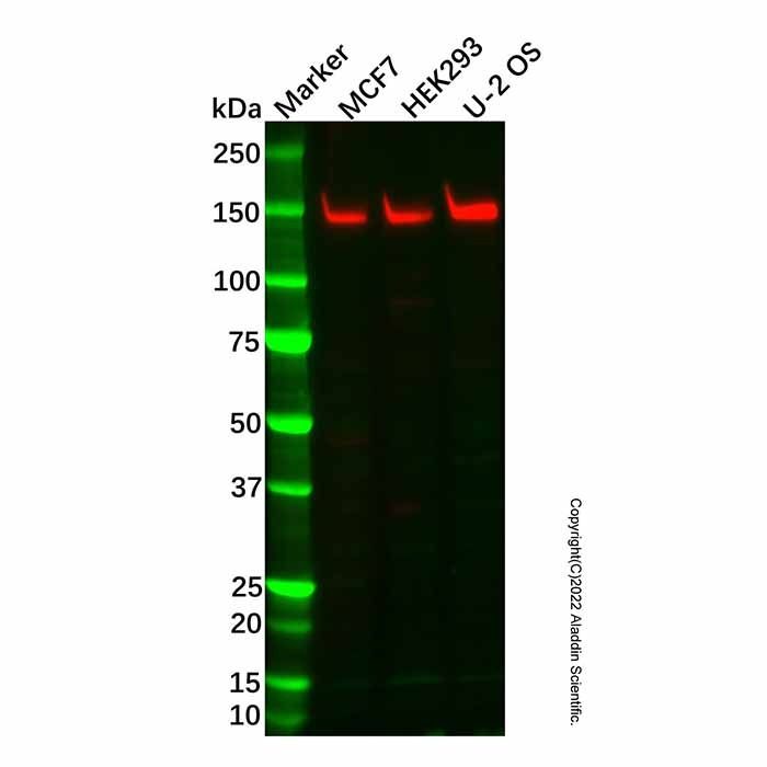 Recombinant KDM4A/JHDM3A/JMJD2A Antibody -    by Aladdin Scientific