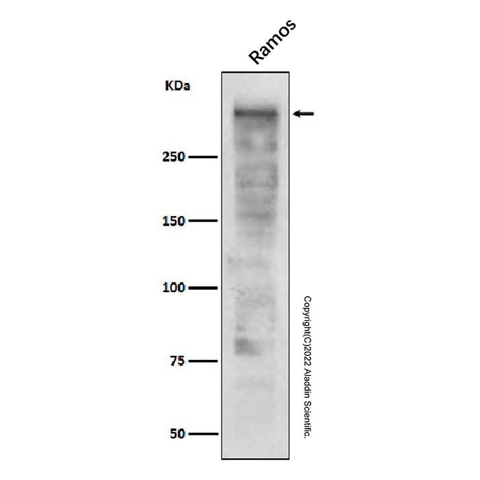 Recombinant Ki67 Antibody -    by Aladdin Scientific