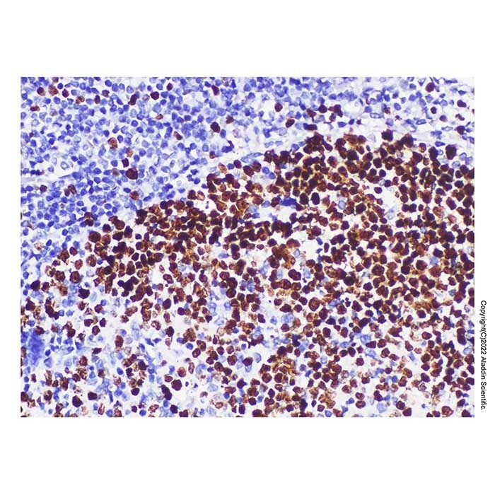 Ki67 Mouse mAb -    by Aladdin Scientific