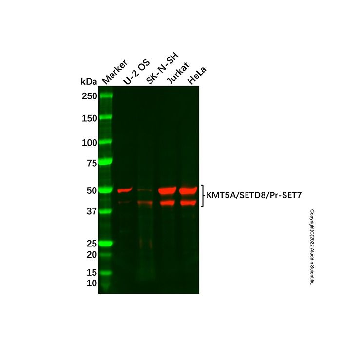 Recombinant KMT5A/SETD8/Pr-SET7 Antibody -    by Aladdin Scientific