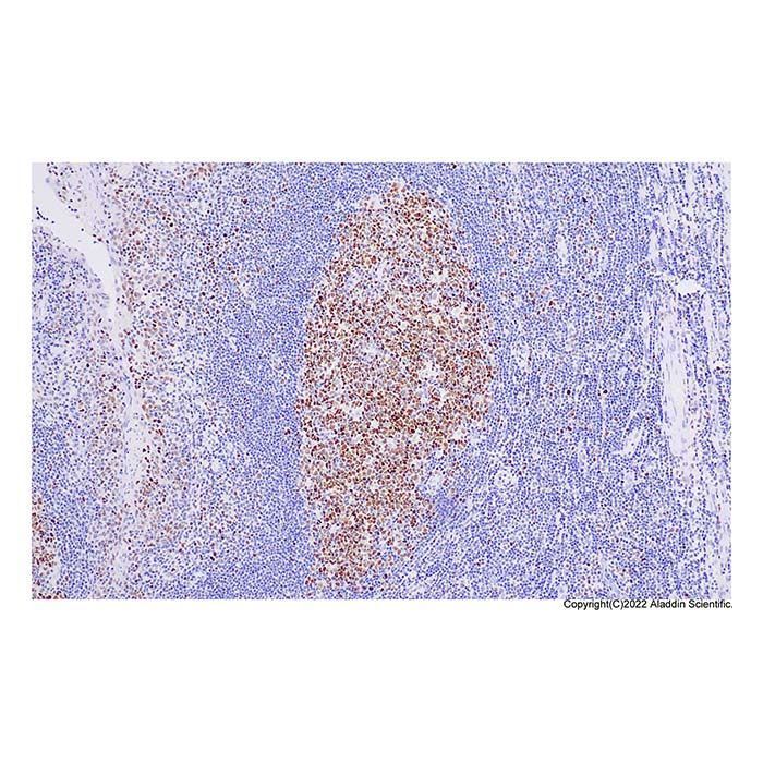 Recombinant KMT6/EZH2 Antibody - by Aladdin Scientific