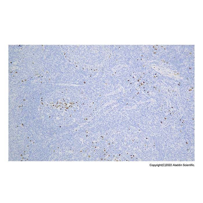 Recombinant Lambda Light chain Antibody -    by Aladdin Scientific