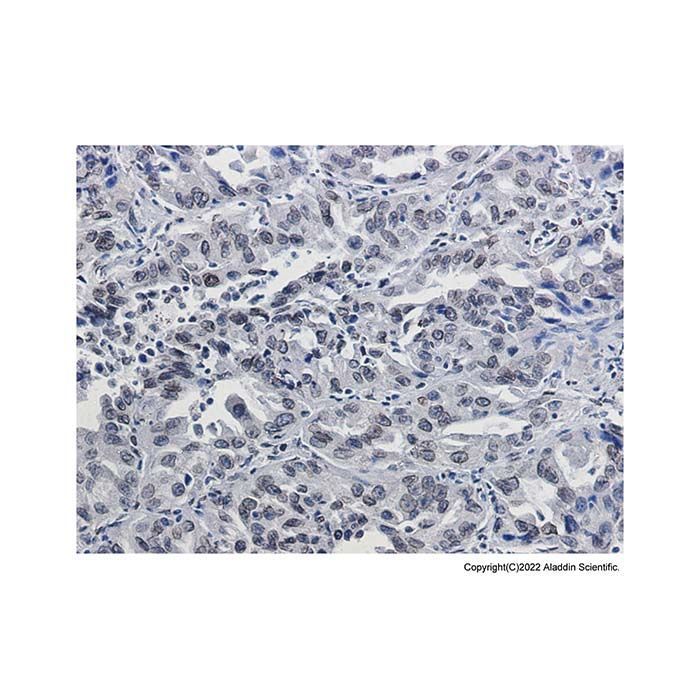 Recombinant Lamin B2 Antibody -    by Aladdin Scientific