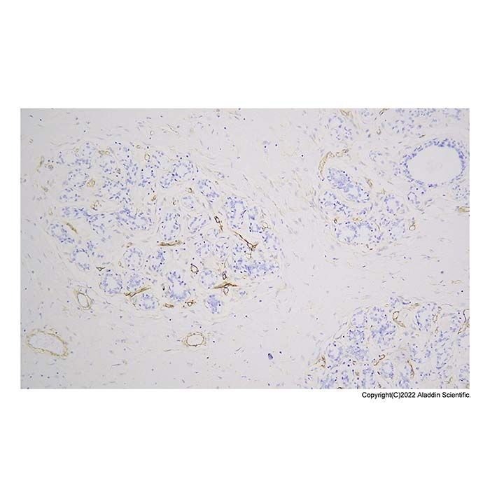 Recombinant Laminin Antibody -    by Aladdin Scientific