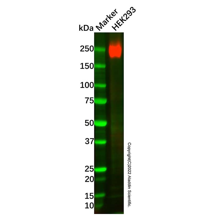 Recombinant Laminin gamma 1 Antibody -    by Aladdin Scientific
