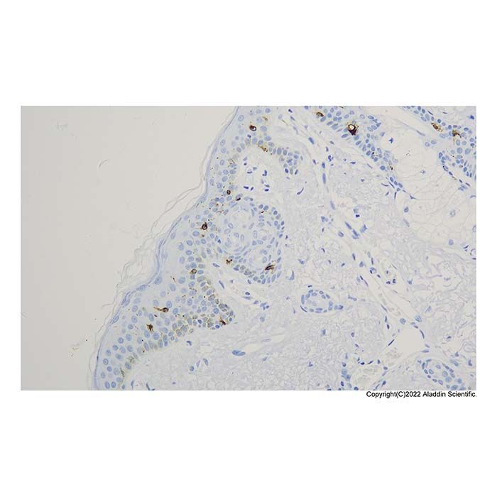 Recombinant Langerin Antibody -    by Aladdin Scientific