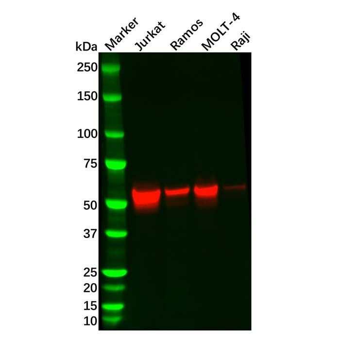 Recombinant Lck Antibody -    by Aladdin Scientific