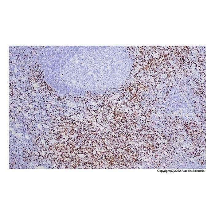 Recombinant LEF1 Antibody -    by Aladdin Scientific