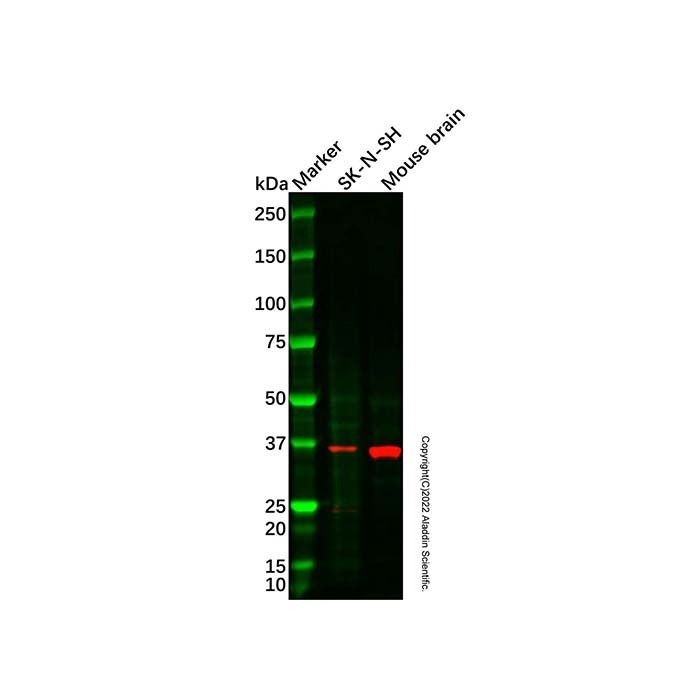 LEFTY2 Antibody -    by Aladdin Scientific