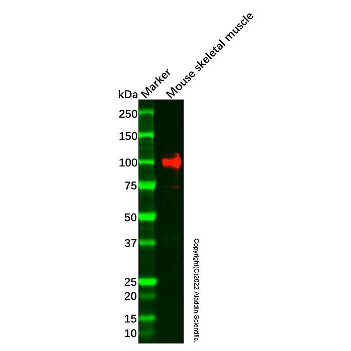 Recombinant LGR5 Antibody -    by Aladdin Scientific