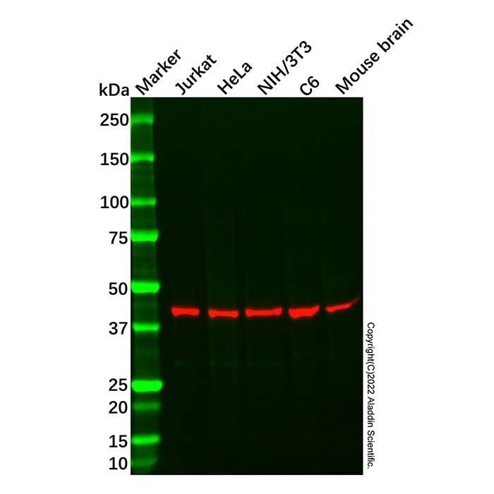 Recombinant LHX3/LIM Antibody -    by Aladdin Scientific