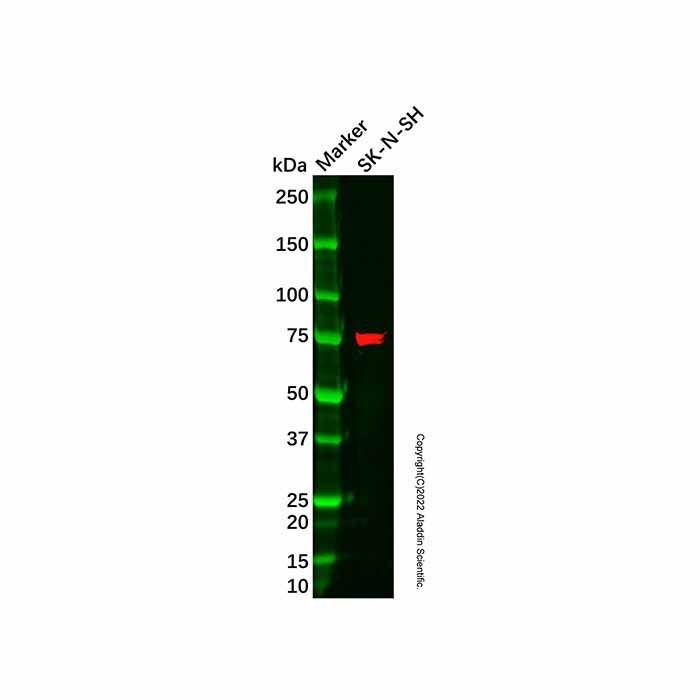 Recombinant LIM Kinase 1 Antibody -    by Aladdin Scientific