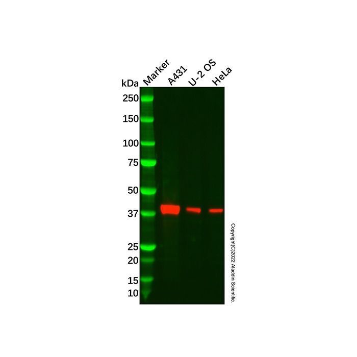 Recombinant LINE-1 ORF1p Antibody -    by Aladdin Scientific
