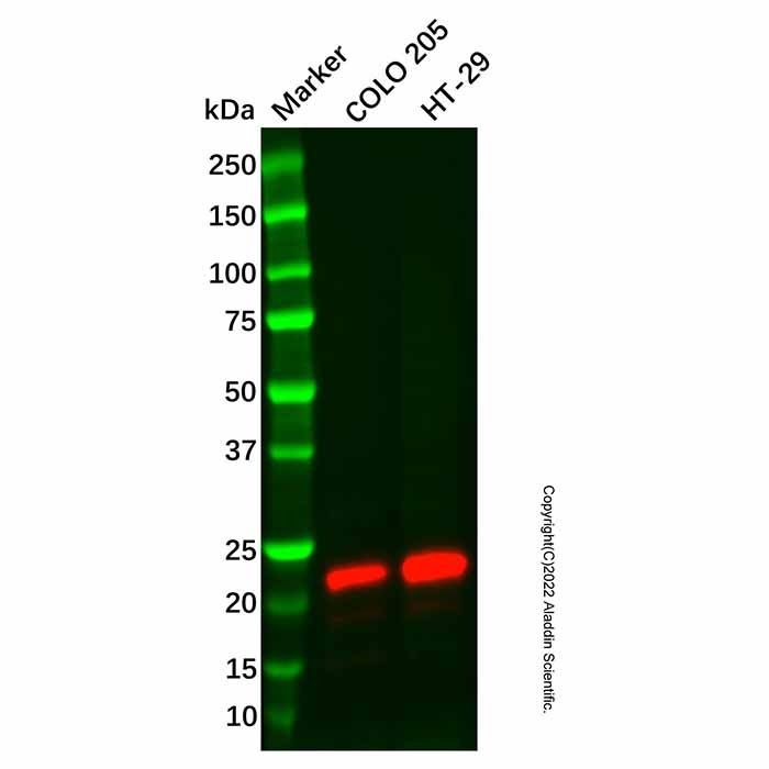 Recombinant Lipocalin-2/NGAL Antibody -    by Aladdin Scientific