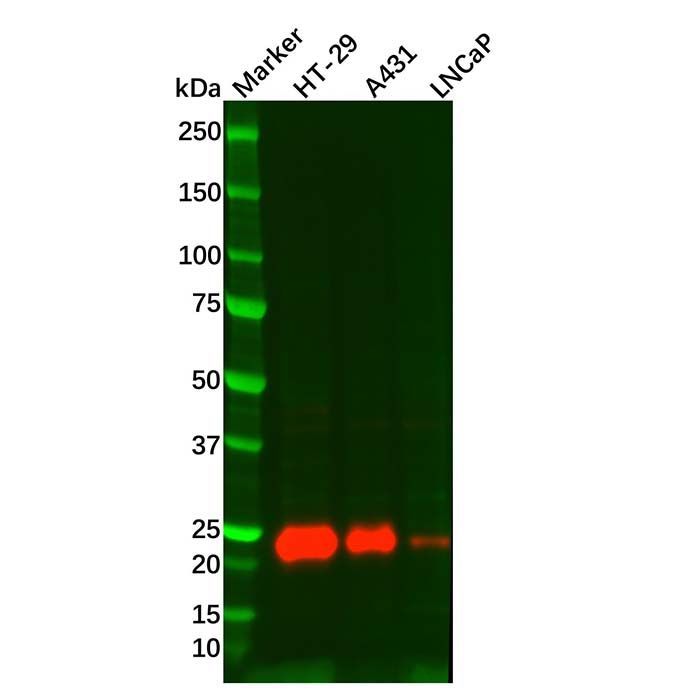 Lipocalin-2/NGAL Mouse mAb -    by Aladdin Scientific