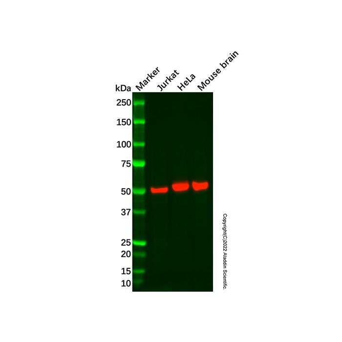 Recombinant LOX Antibody -    by Aladdin Scientific