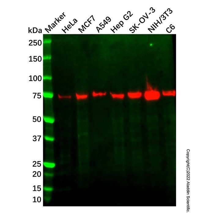 Recombinant LPP Antibody -    by Aladdin Scientific