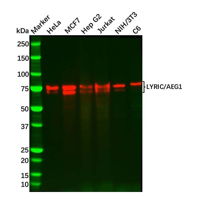 Recombinant LYRIC/AEG1 Antibody -    by Aladdin Scientific