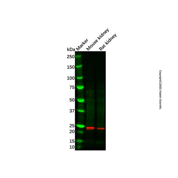 Recombinant Lysophospholipase 1/LPL-I Antibody -    by Aladdin Scientific