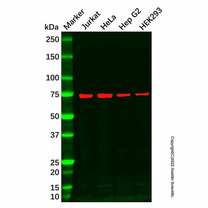 Recombinant LysRS Antibody -    by Aladdin Scientific