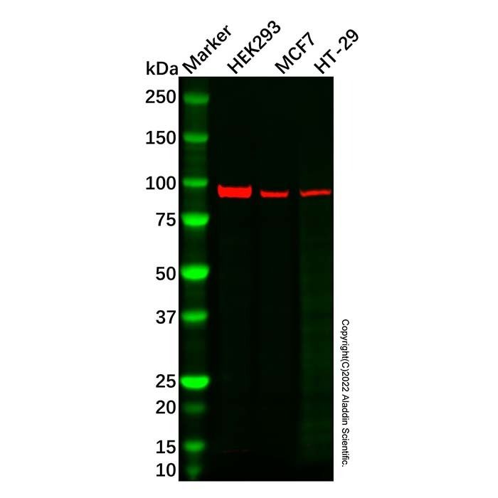 MACC1 Antibody -    by Aladdin Scientific