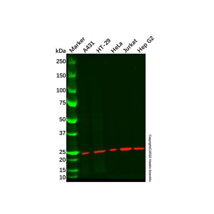 Recombinant Mad2L1 Antibody -    by Aladdin Scientific