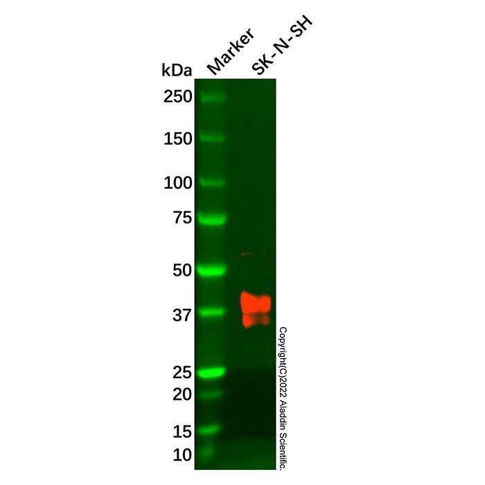 Recombinant MAGE3 Antibody -    by Aladdin Scientific