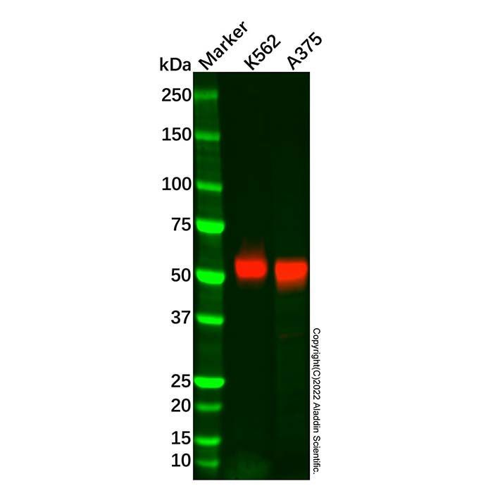 Recombinant MAGEC2 Antibody -    by Aladdin Scientific