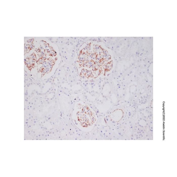 Recombinant Mast Cell Tryptase Antibody -    by Aladdin Scientific