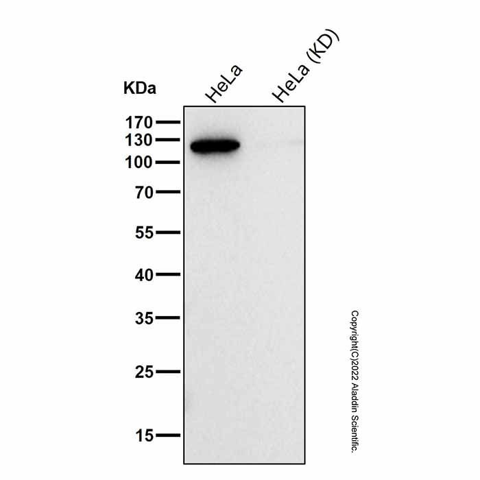 Recombinant Matrin 3 Antibody -    by Aladdin Scientific