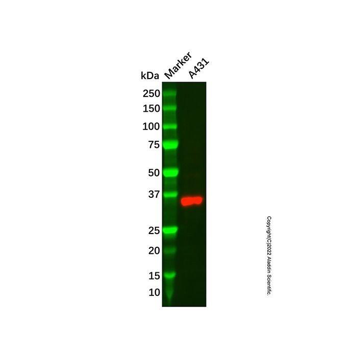 Recombinant MC1-R Antibody -    by Aladdin Scientific