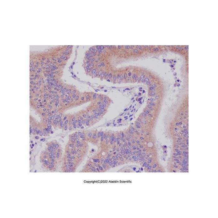 Recombinant MCJ Antibody -    by Aladdin Scientific
