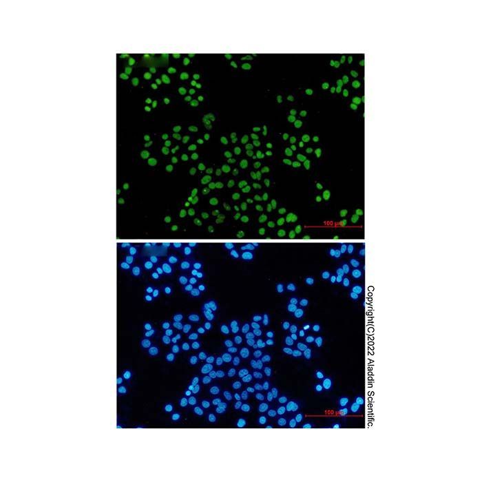 Recombinant MCM2 Antibody -    by Aladdin Scientific