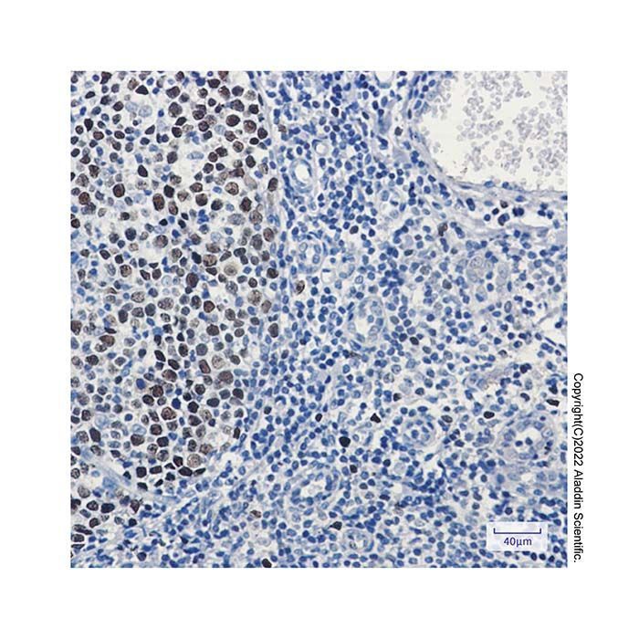 Recombinant MCM3 Antibody -    by Aladdin Scientific