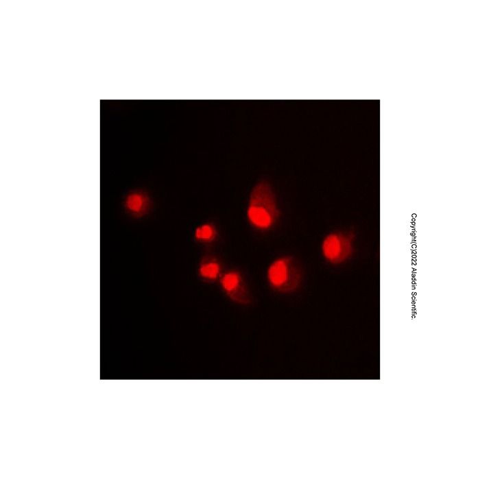 MDM2 Antibody -    by Aladdin Scientific