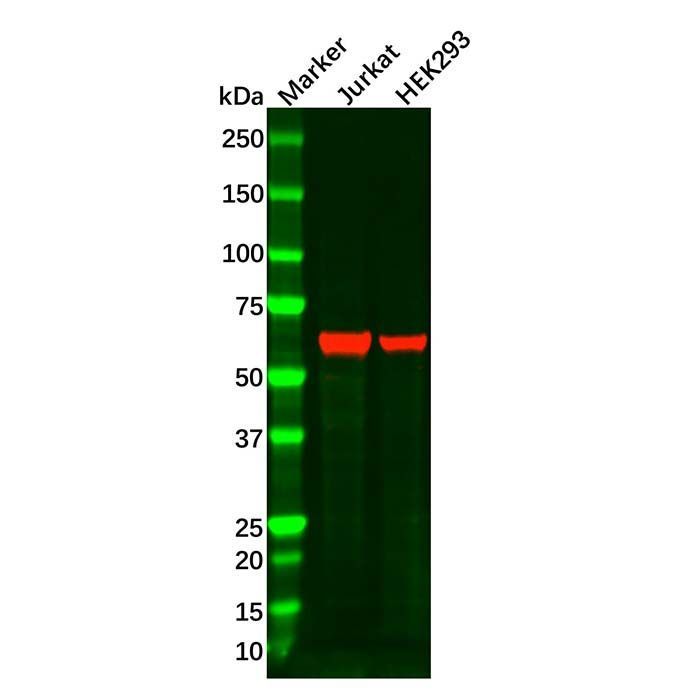 ME2 Antibody -    by Aladdin Scientific