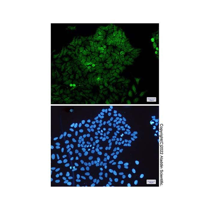 Recombinant MEK3 Antibody -    by Aladdin Scientific