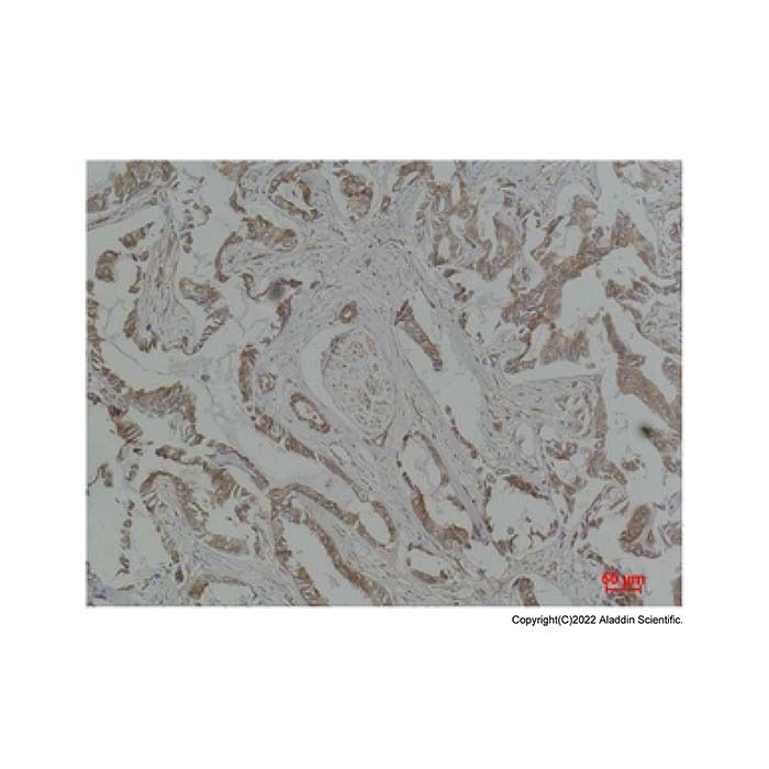 MEK5 Antibody -    by Aladdin Scientific