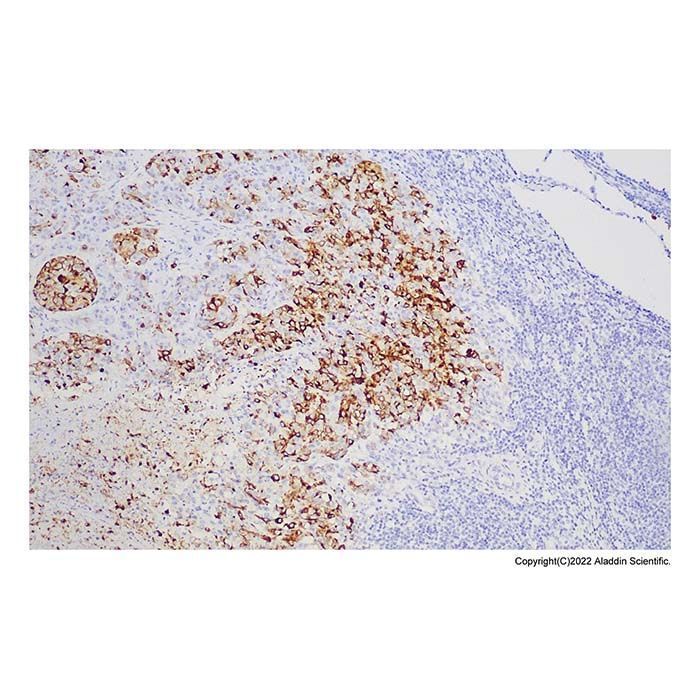 Recombinant Melanoma gp100 Antibody -    by Aladdin Scientific